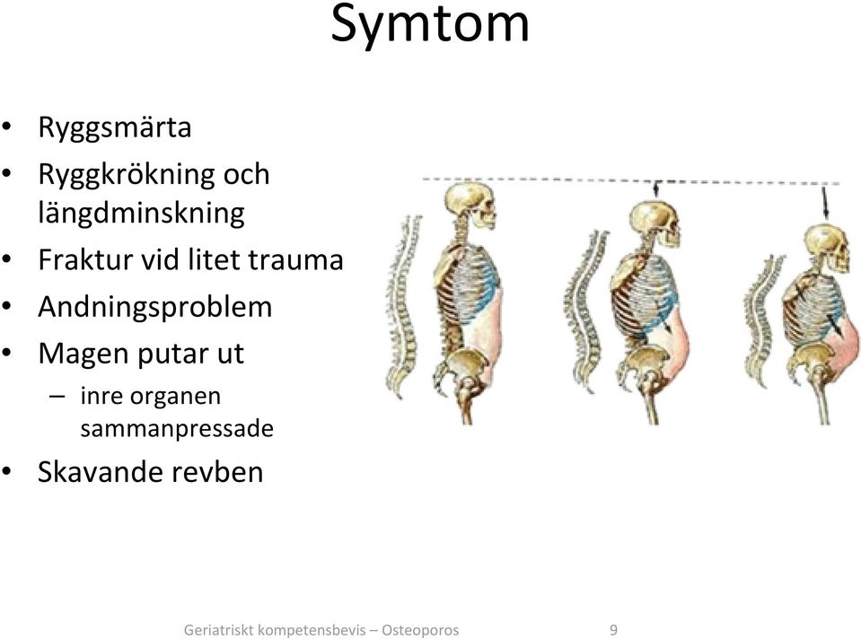 Andningsproblem Magen putar ut inre organen