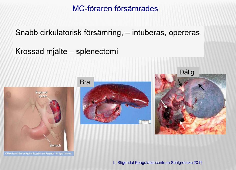 intuberas, opereras Krossad