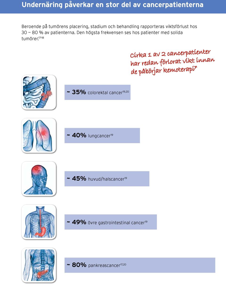 17-18 Cirka 1 av 2 cancerpatienter har redan förlorat vikt innan de påbörjar kemoterapi 7 ~ 35% colorektal