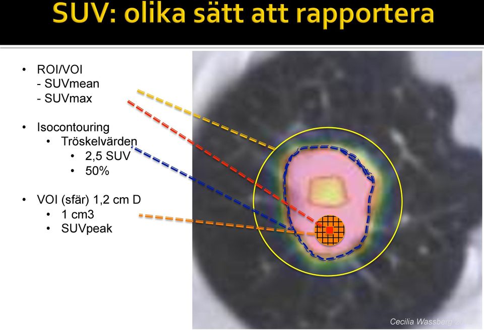 2,5 SUV 50% VOI (sfär) 1,2 cm