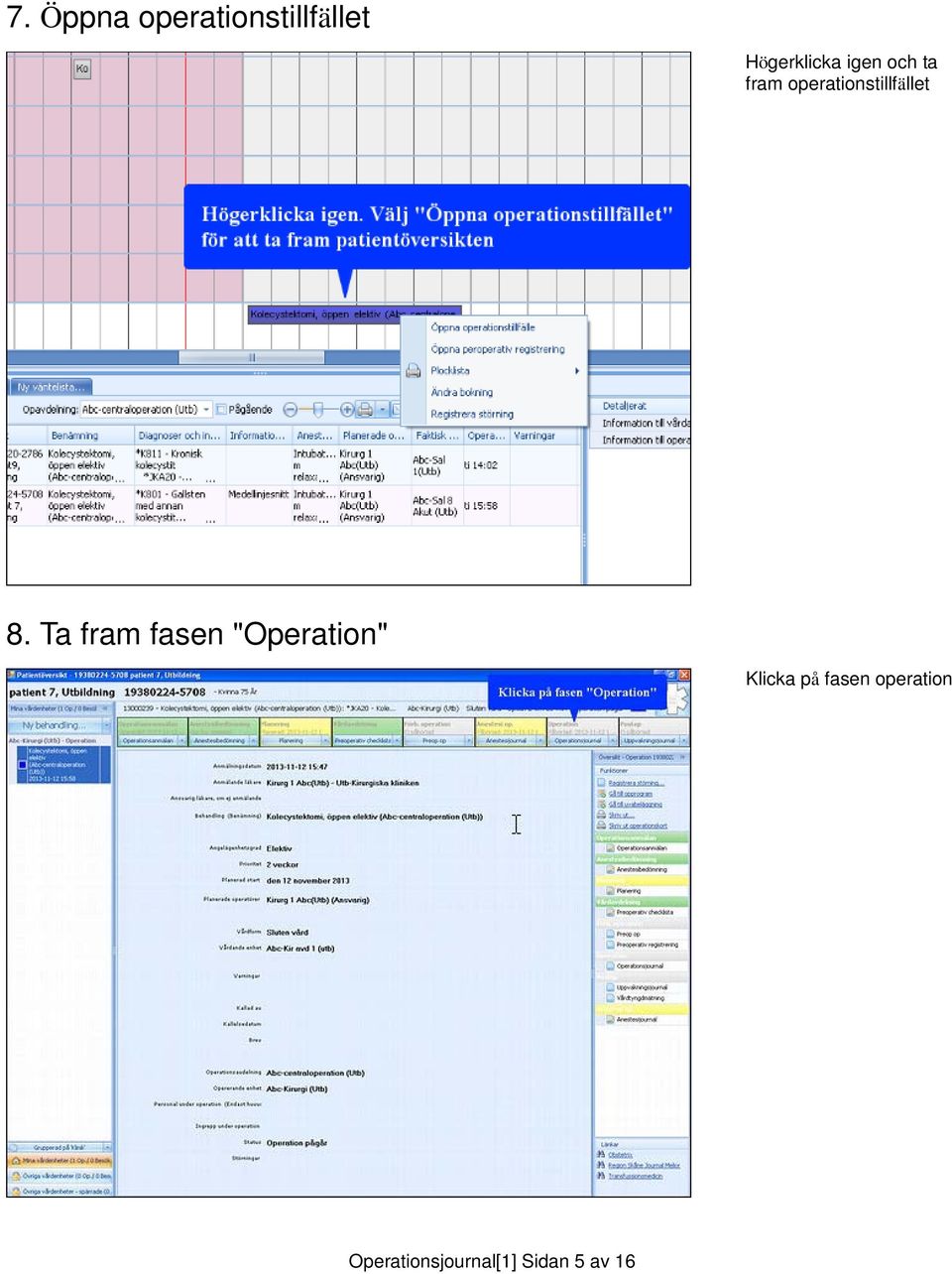 Ta fram fasen "Operation" Klicka på fasen