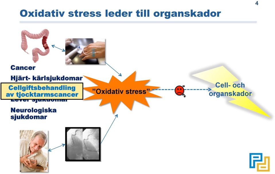 strålning av tjocktarmscancer Lever sjukdomar