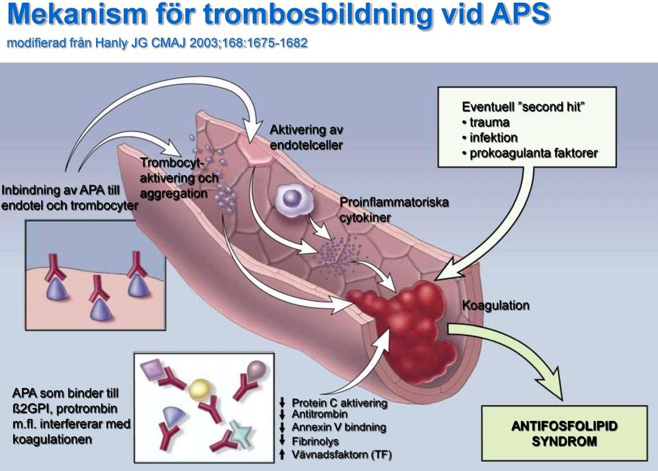 second hit trauma infektion prokoagulanta faktorer Koagulation APA som binder till ß2GPI, protrombin m.fl.