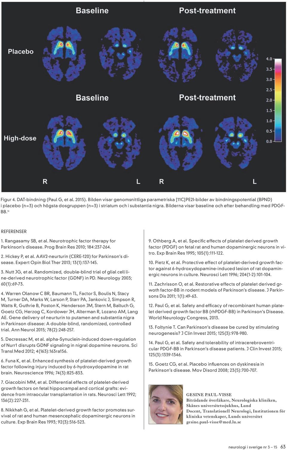 Bilderna visar baseline och efter behandling med PDGF- BB. 14 REFERENSER 1. Rangasamy SB, et al. Neurotrophic factor therapy for Parkinson s disease. Prog Brain Res 2010; 184:237-264. 2. Hickey P, et al.