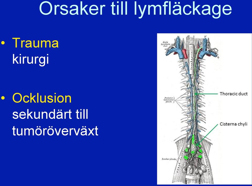 kirurgi Ocklusion