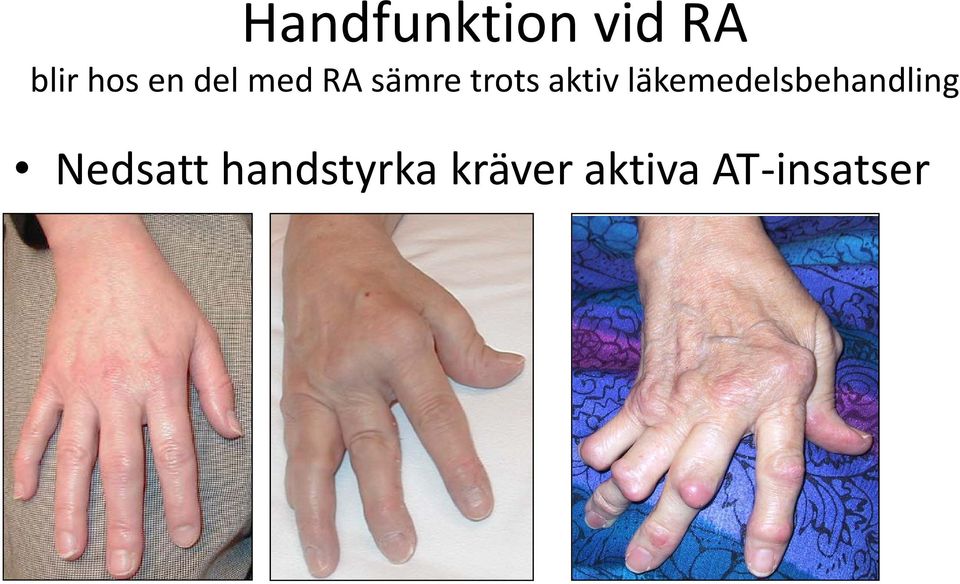 läkemedelsbehandling Nedsatt