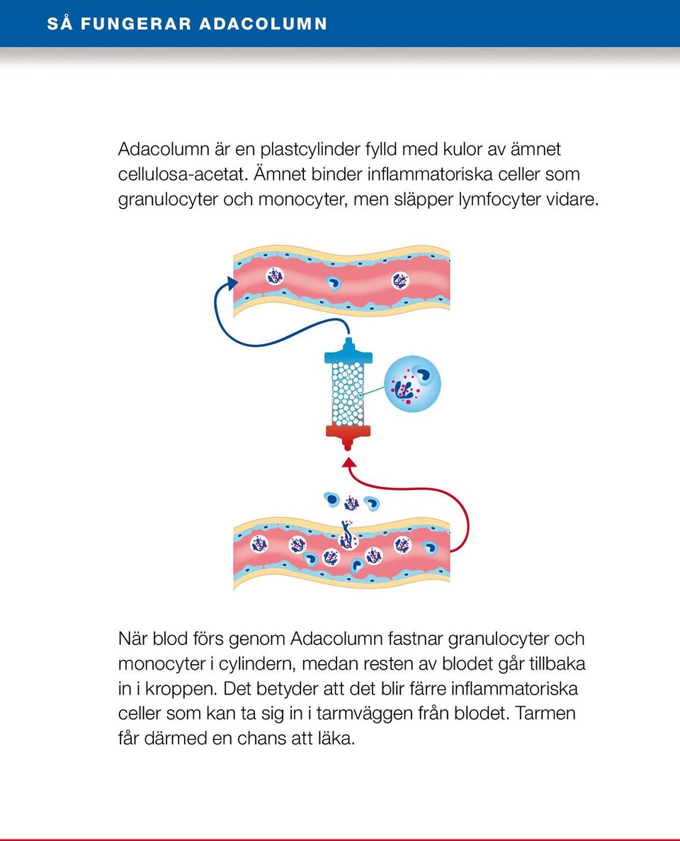 När blod förs genom Adacolumn fastnar granulocyter och monocyter i cylindern, medan resten av blodet går tillbaka