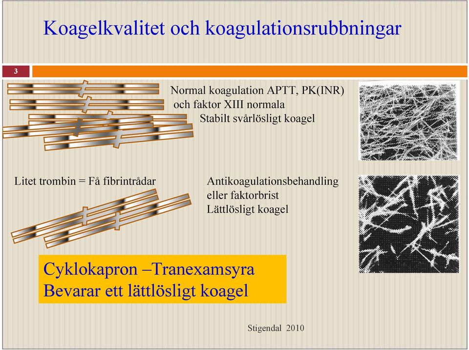 trombin = Få fibrintrådar Antikoagulationsbehandling eller