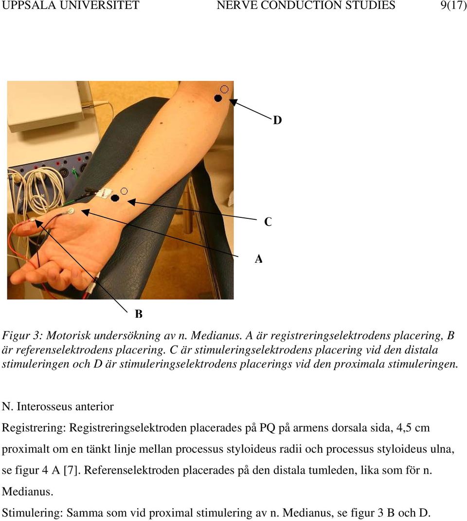 C är stimuleringselektrodens placering vid den distala stimuleringen och D är stimuleringselektrodens placerings vid den proximala stimuleringen. N.