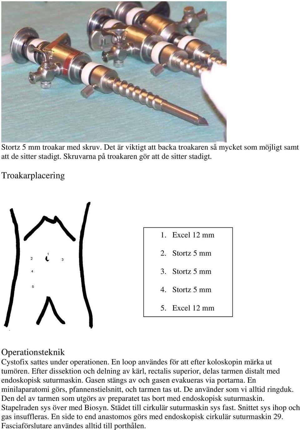 Efter dissektion och delning av kärl, rectalis superior, delas tarmen distalt med endoskopisk suturmaskin. Gasen stängs av och gasen evakueras via portarna.