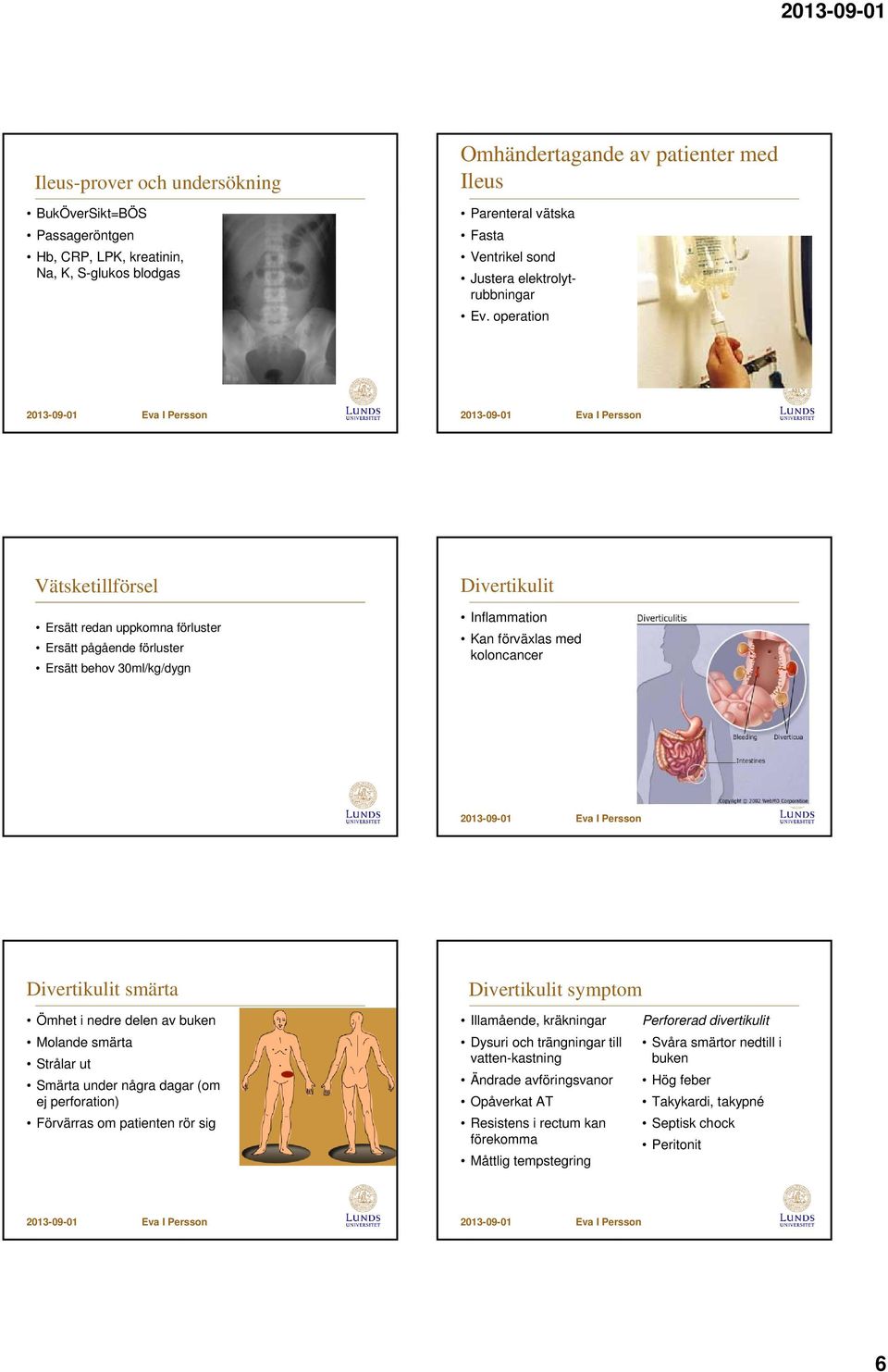 Divertikulit symptom Ömhet i nedre delen av buken Molande smärta Strålar ut Smärta under några dagar (om ej perforation) Förvärras om patienten rör sig Illamående, kräkningar Dysuri och trängningar