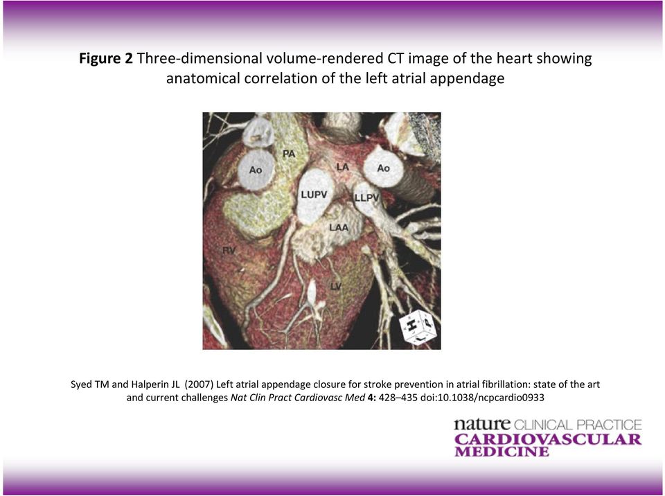 appendage closure for stroke prevention in atrial fibrillation: state of the art and