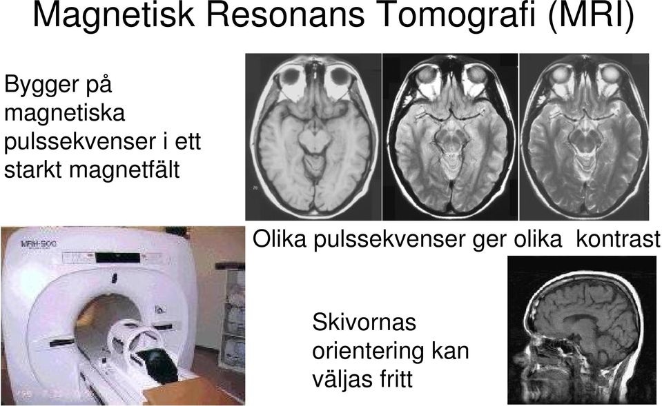 magnetfält Olika pulssekvenser ger olika