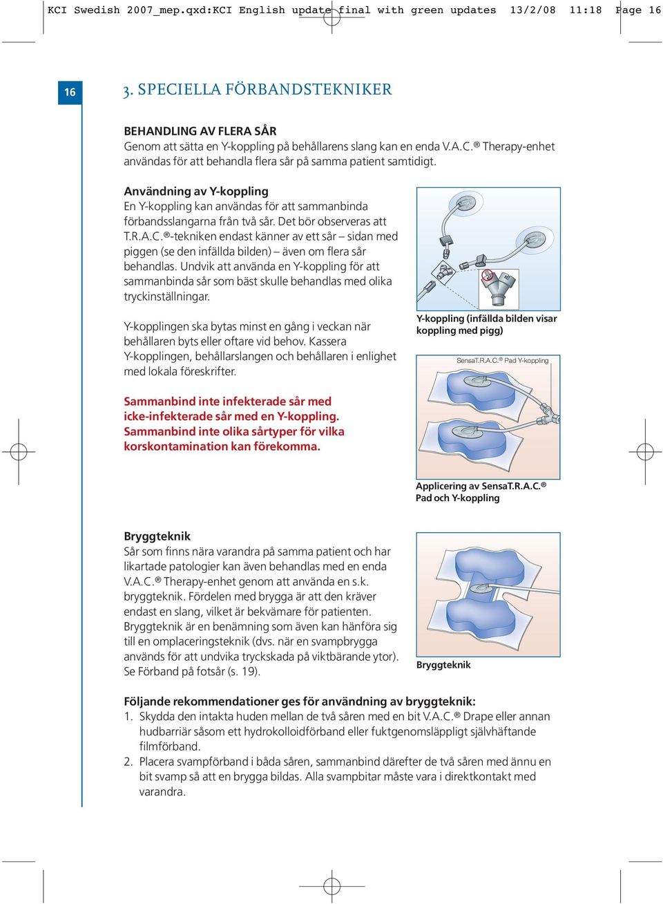 Användning av Y-koppling En Y-koppling kan användas för att sammanbinda förbandsslangarna från två sår. Det bör observeras att T.R.A.C.