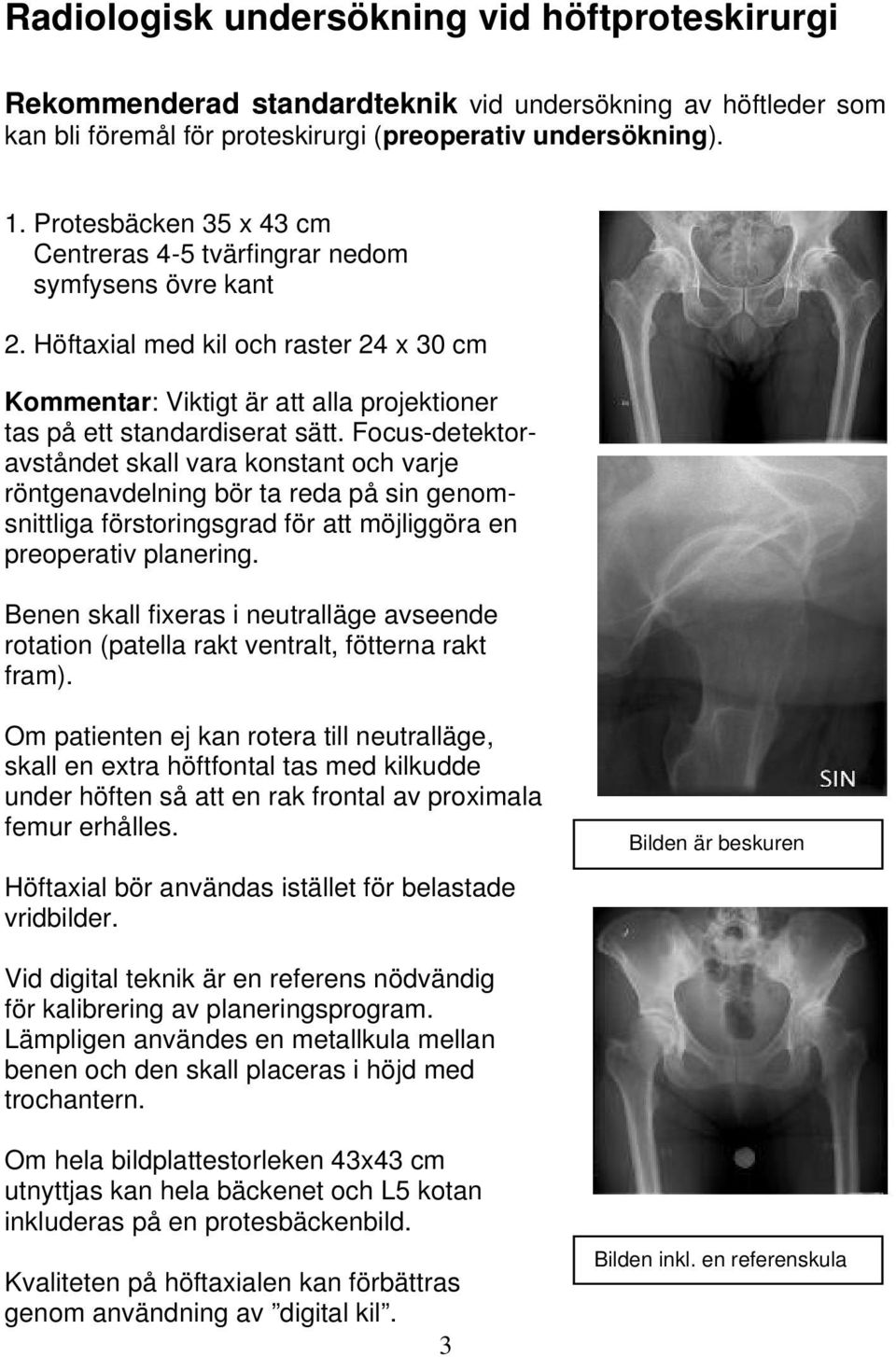 Focus-detektoravståndet skall vara konstant och varje röntgenavdelning bör ta reda på sin genomsnittliga förstoringsgrad för att möjliggöra en preoperativ planering.