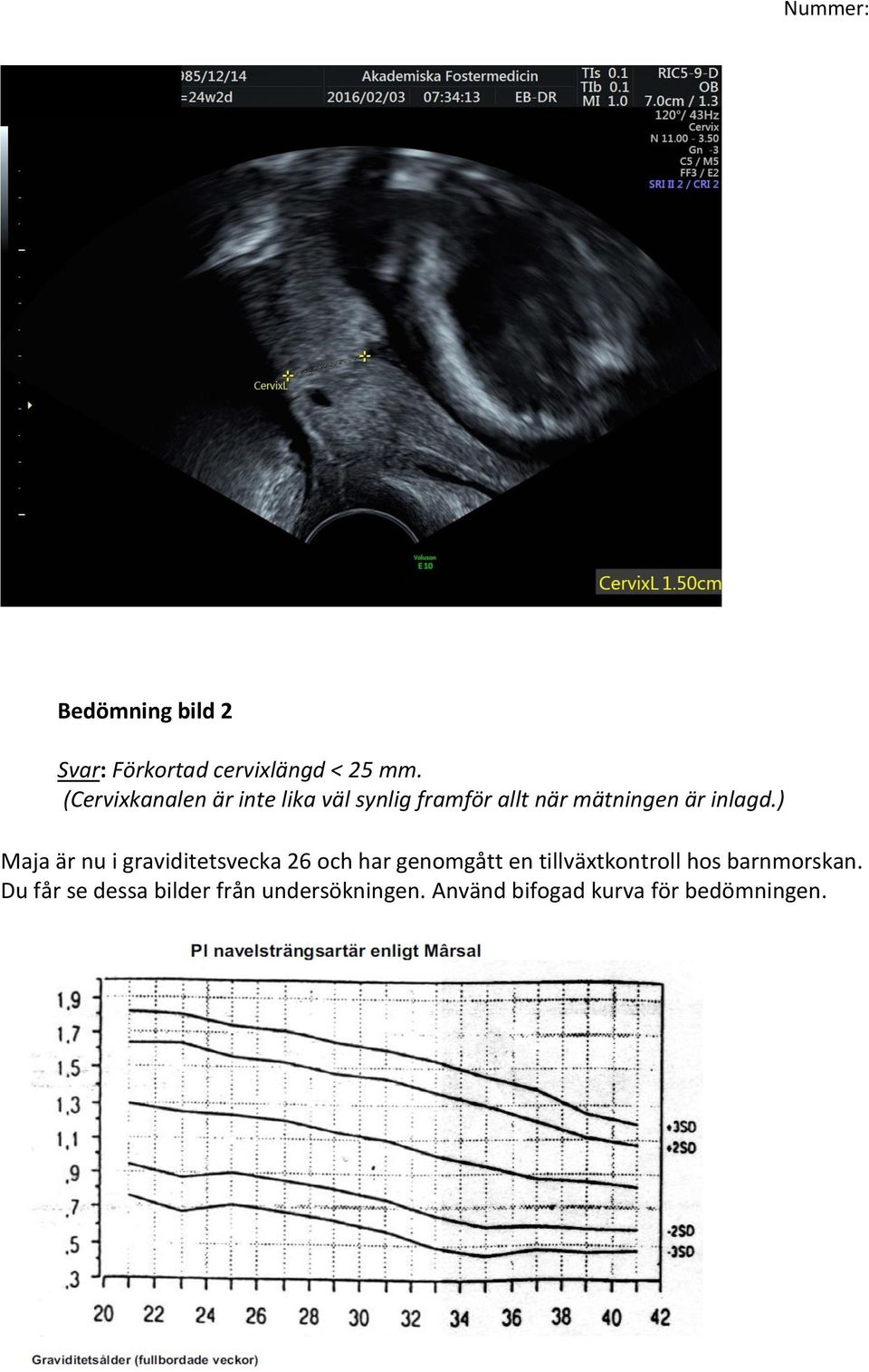 ) Maja är nu i graviditetsvecka 26 och har genomgått en tillväxtkontroll