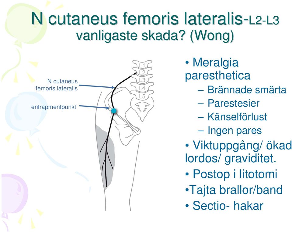 Meralgia paresthetica Brännade smärta Parestesier Känselförlust