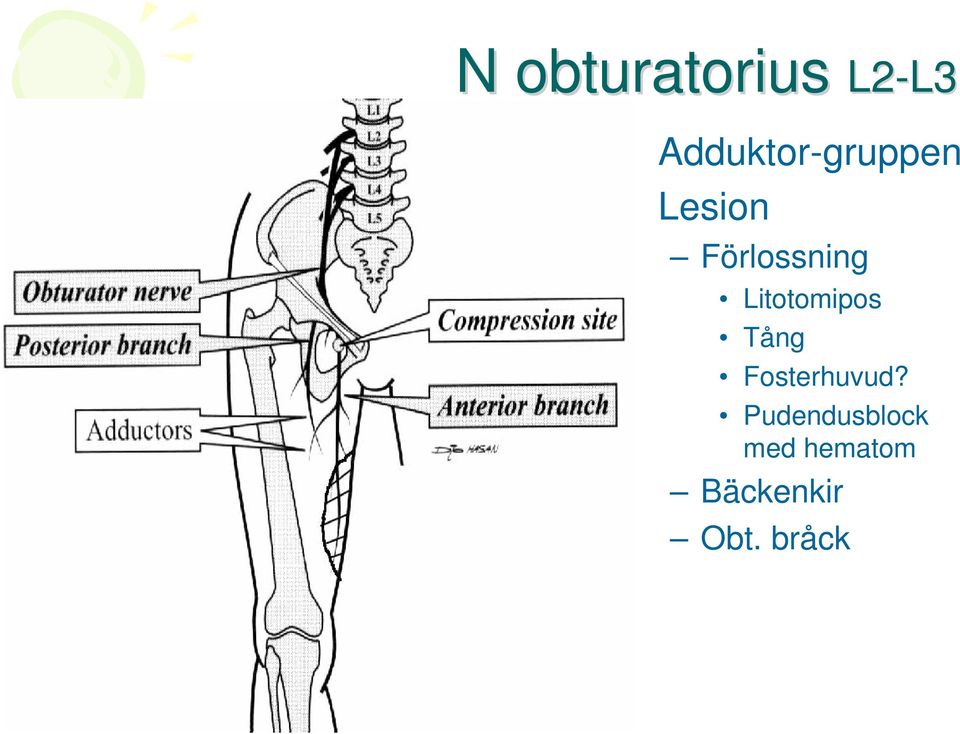 Förlossning Litotomipos Tång