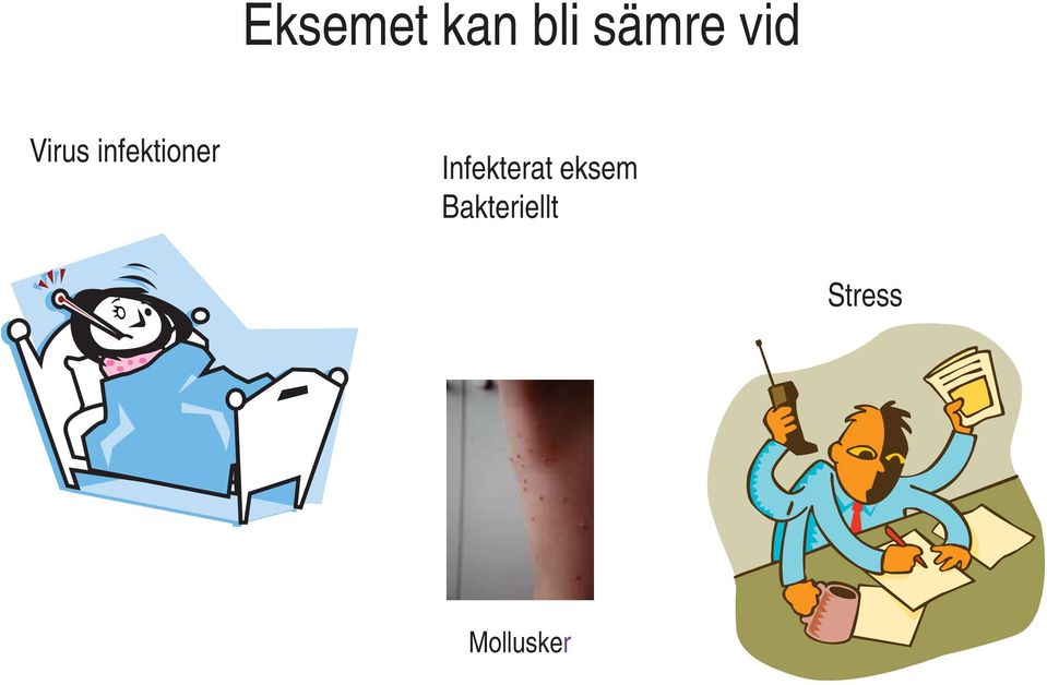 Infekterat eksem