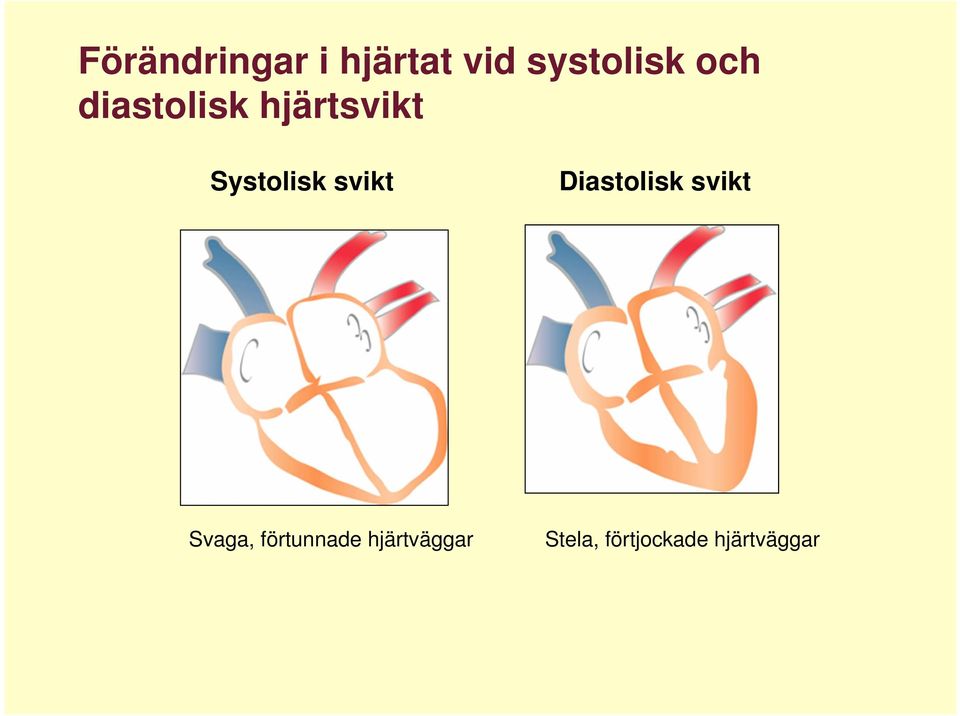 svikt Diastolisk svikt Svaga,