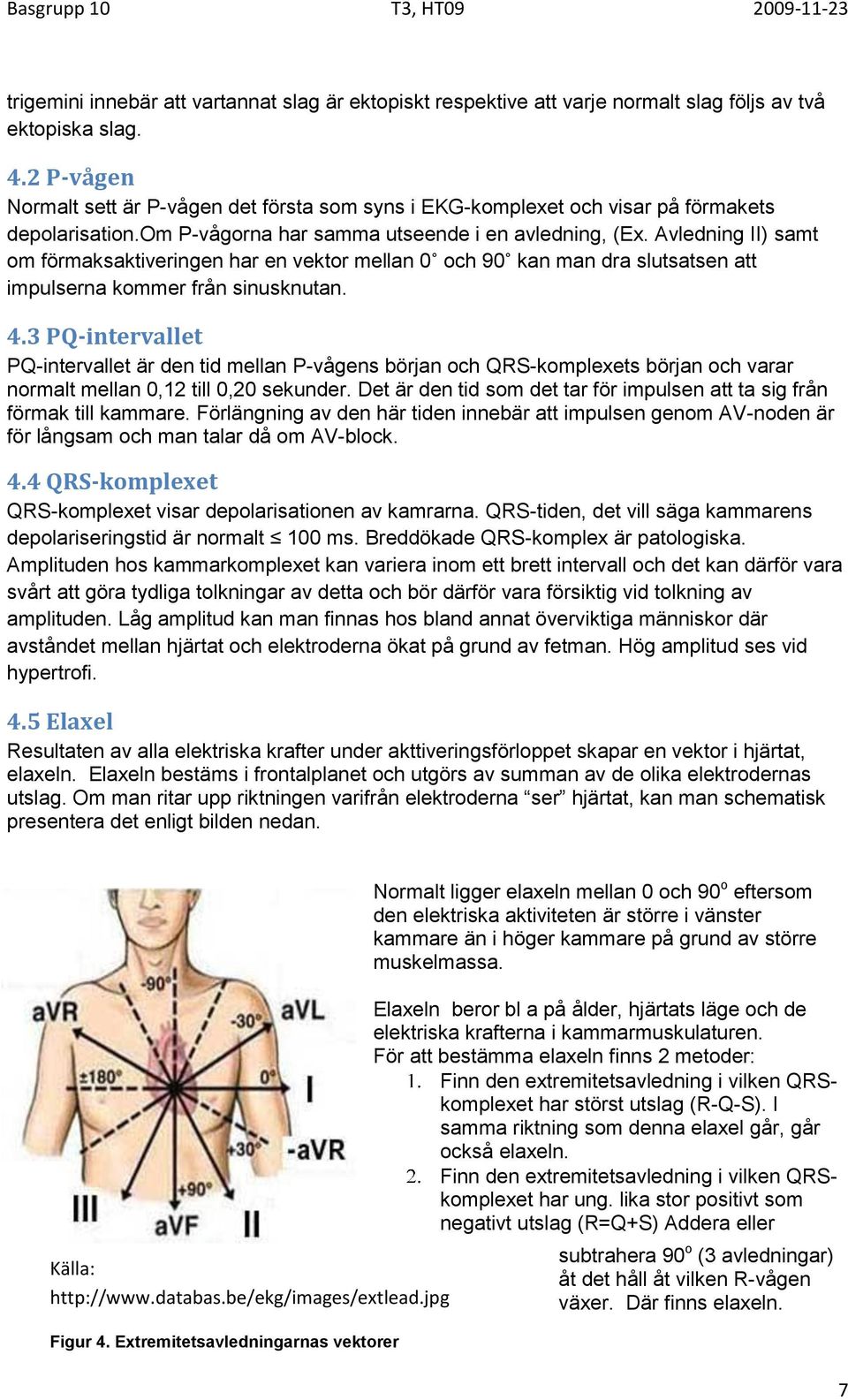 Avledning II) samt om förmaksaktiveringen har en vektor mellan 0 och 90 kan man dra slutsatsen att impulserna kommer från sinusknutan. 4.