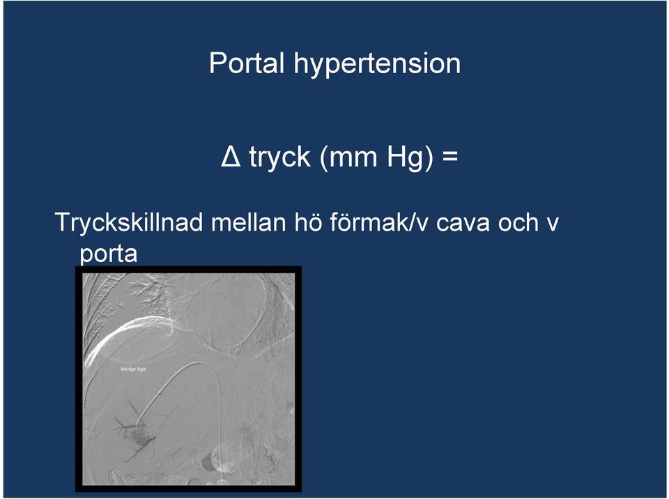 Tryckskillnad mellan