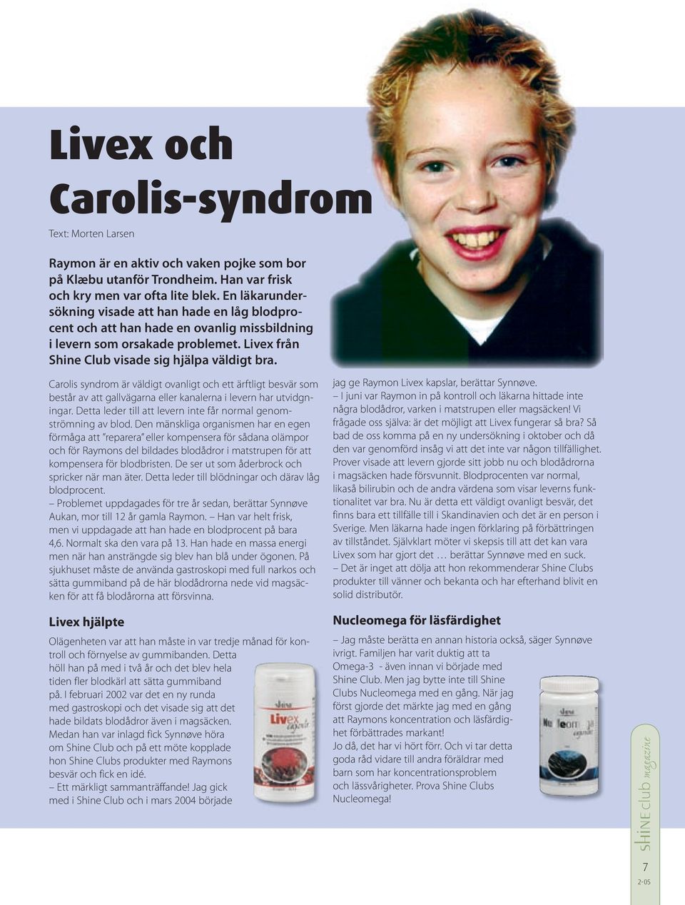 Carolis syndrom är väldigt ovanligt och ett ärftligt besvär som består av att gallvägarna eller kanalerna i levern har utvidgningar. Detta leder till att levern inte får normal genomströmning av blod.