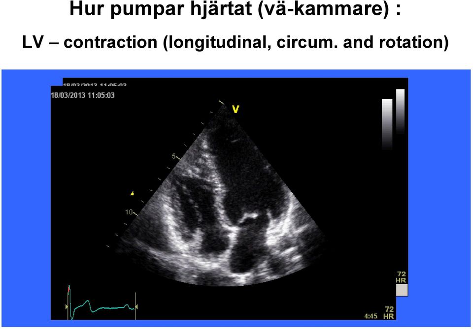 contraction