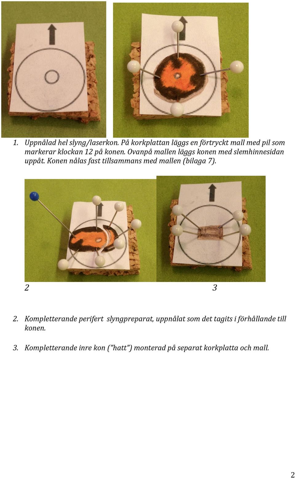 Ovanpå mallen läggs konen med slemhinnesidan uppåt.