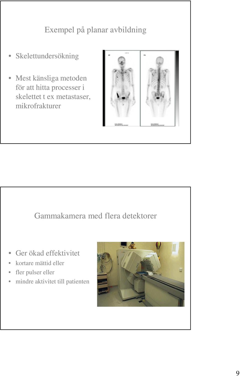 mikrofrakturer Gammakamera med flera detektorer Ger ökad