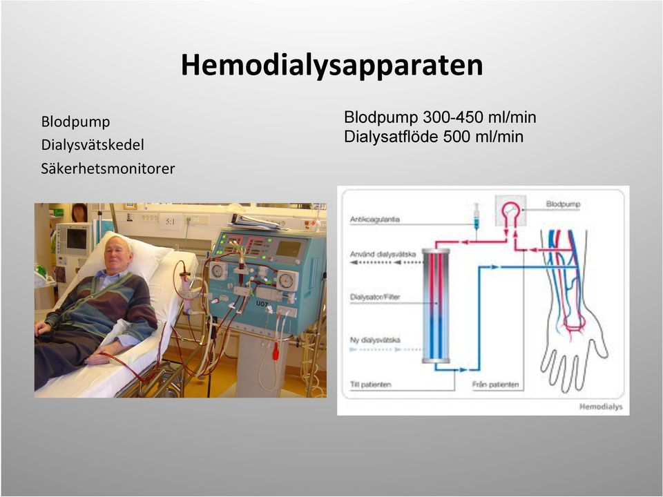 Säkerhetsmonitorer Blodpump