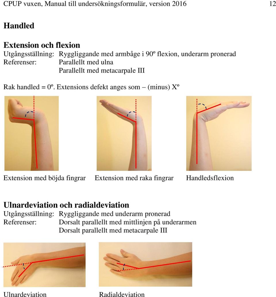 Extensions defekt anges som (minus) Xº Extension med böjda fingrar Extension med raka fingrar Handledsflexion Ulnardeviation och radialdeviation