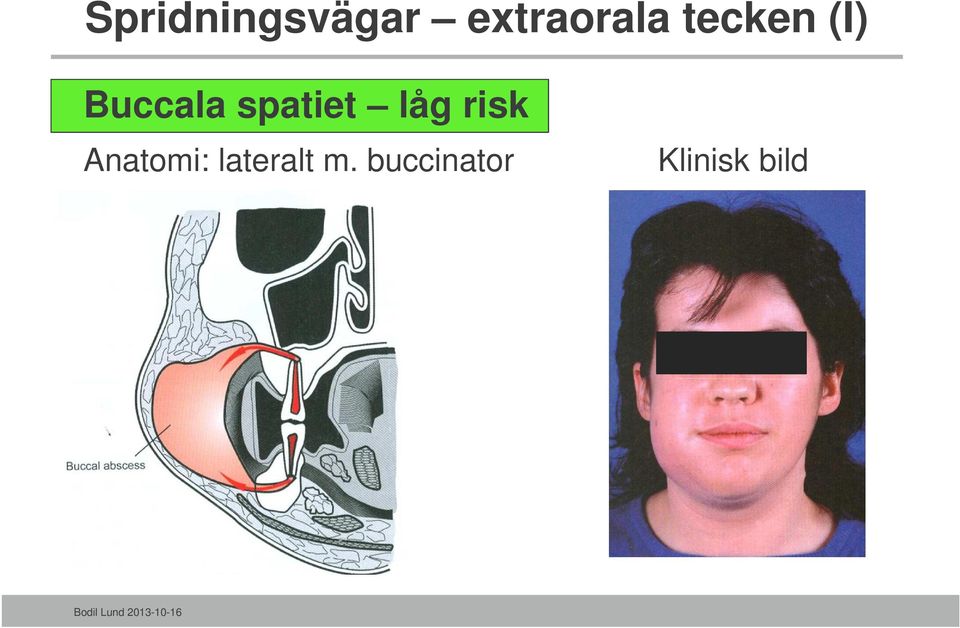 låg risk Anatomi: lateralt