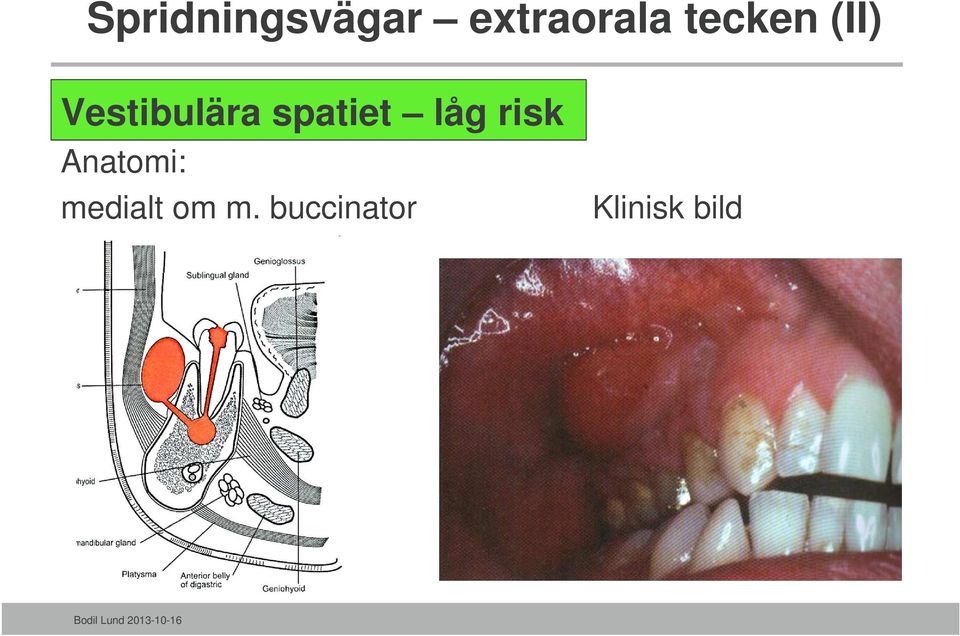 spatiet låg risk Anatomi: