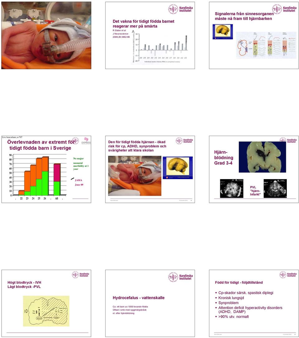 risk för cp, ADHD, synproblem och svårigheter att klara skolan % Hjärnblödning Grad 3-4 No major neonatal morbidity at 1 year JAMA June 09 PVL hjärninfarkt wks Högt blodtryck - IVH Lågt blodtryck