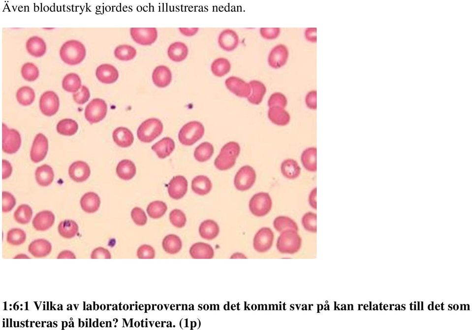 1:6:1 Vilka av laboratorieproverna som det