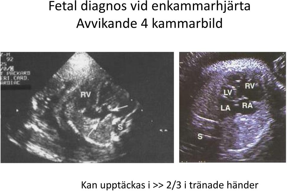 Avvikande 4 kammarbild