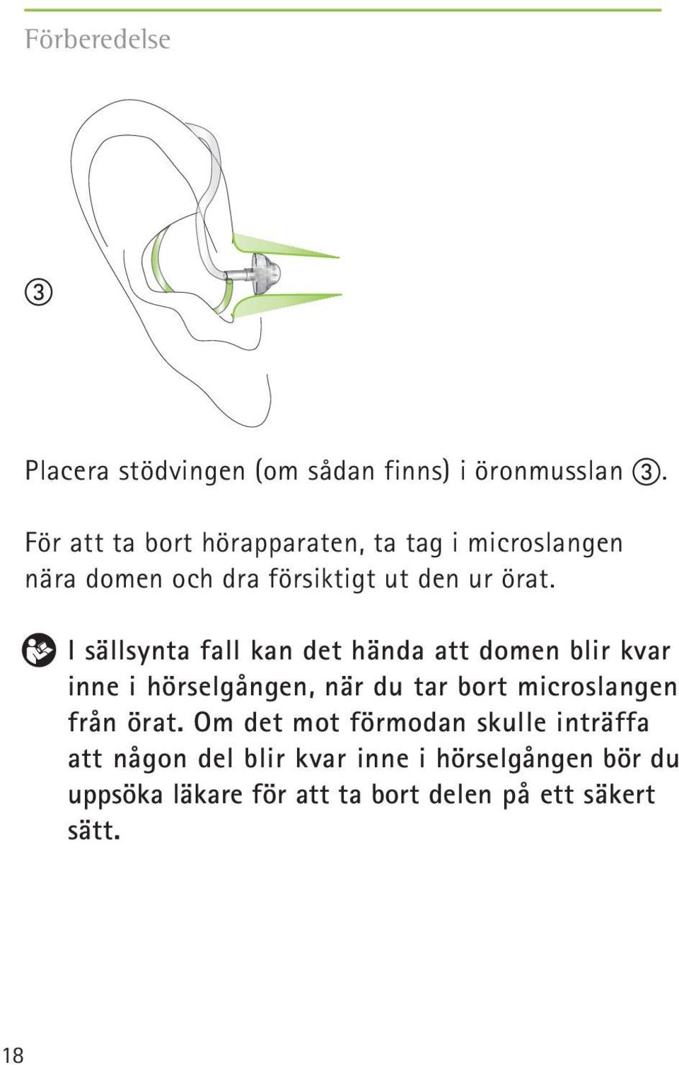 I sällsynta fall kan det hända att domen blir kvar inne i hörselgången, när du tar bort microslangen