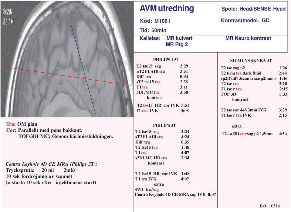 5T T2 tse15 sag 2:29 st2 FLAIR tra 3:51 Diff tra 0:34 st2 tse15 tra 2.