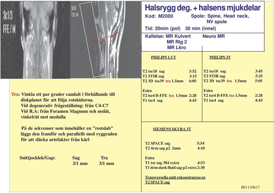 A: från Foramen Magnum och nedåt, vinkelrät mot medulla T2 tse18 sag 3:52 T2 STIR sag 3:15 T2 3D tse39 tra 1.5mm 6:05 Extra T2 tse4 B-FFE tra 1.