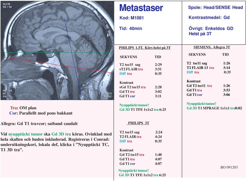 Körs helst på 3T SEKVENS T2 tse15 sag 2:29 st2 FLAIR tra 3:51 Diff tra 0:35 Kontrast sgd T2 tse15 tra 2:28 Gd T1 tra 3:02 Gd T1 cor 3:11 Nyupptäckt tumor!