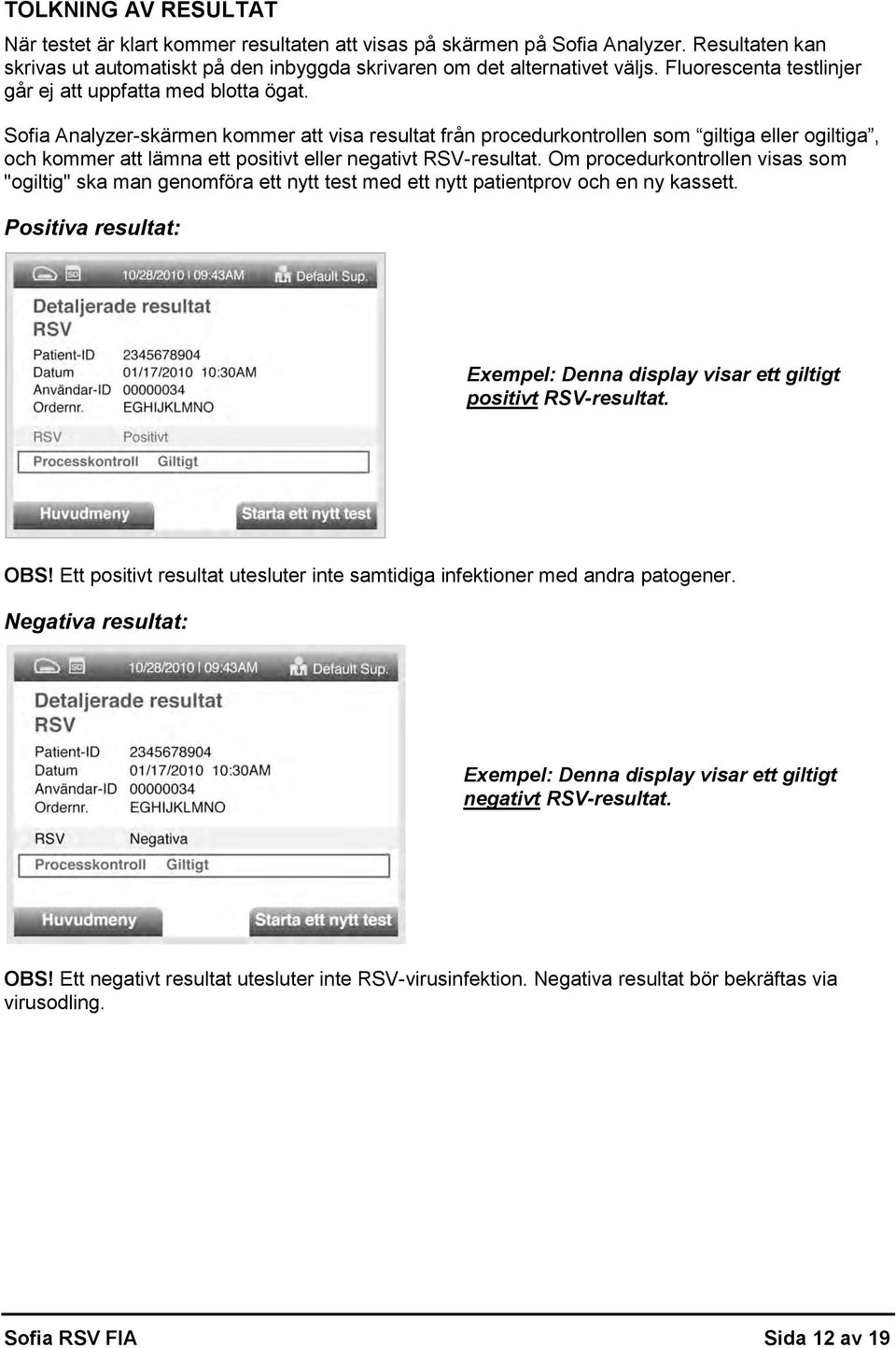 Sofia Analyzer-skärmen kommer att visa resultat från procedurkontrollen som giltiga eller ogiltiga, och kommer att lämna ett positivt eller negativt RSV-resultat.