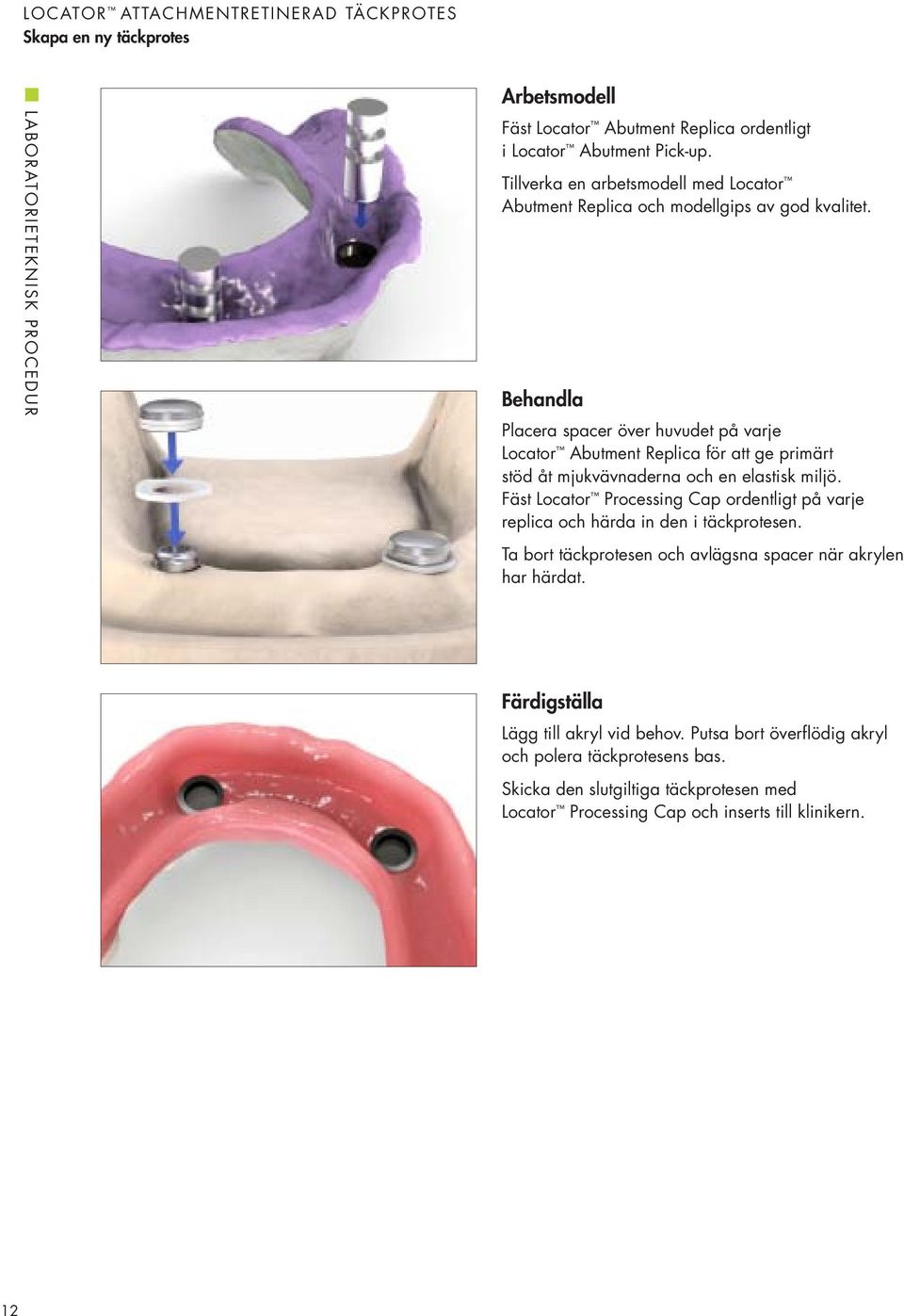 Behandla Placera spacer över huvudet på varje Locator Abutment Replica för att ge primärt stöd åt mjukvävnaderna och en elastisk miljö.