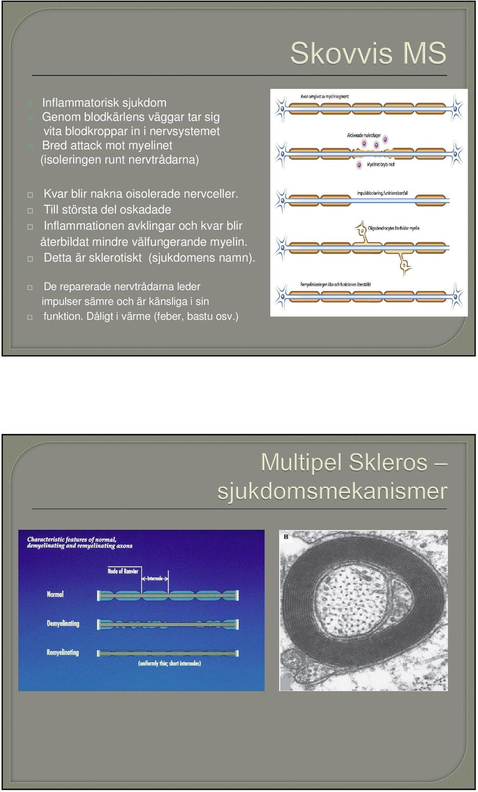 Till största del oskadade Inflammationen avklingar och kvar blir återbildat mindre välfungerande myelin.