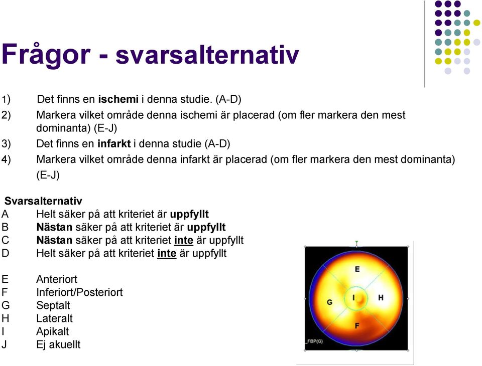 4) Markera vilket område denna infarkt är placerad (om fler markera den mest dominanta) (E-J) Svarsalternativ A Helt säker på att kriteriet är