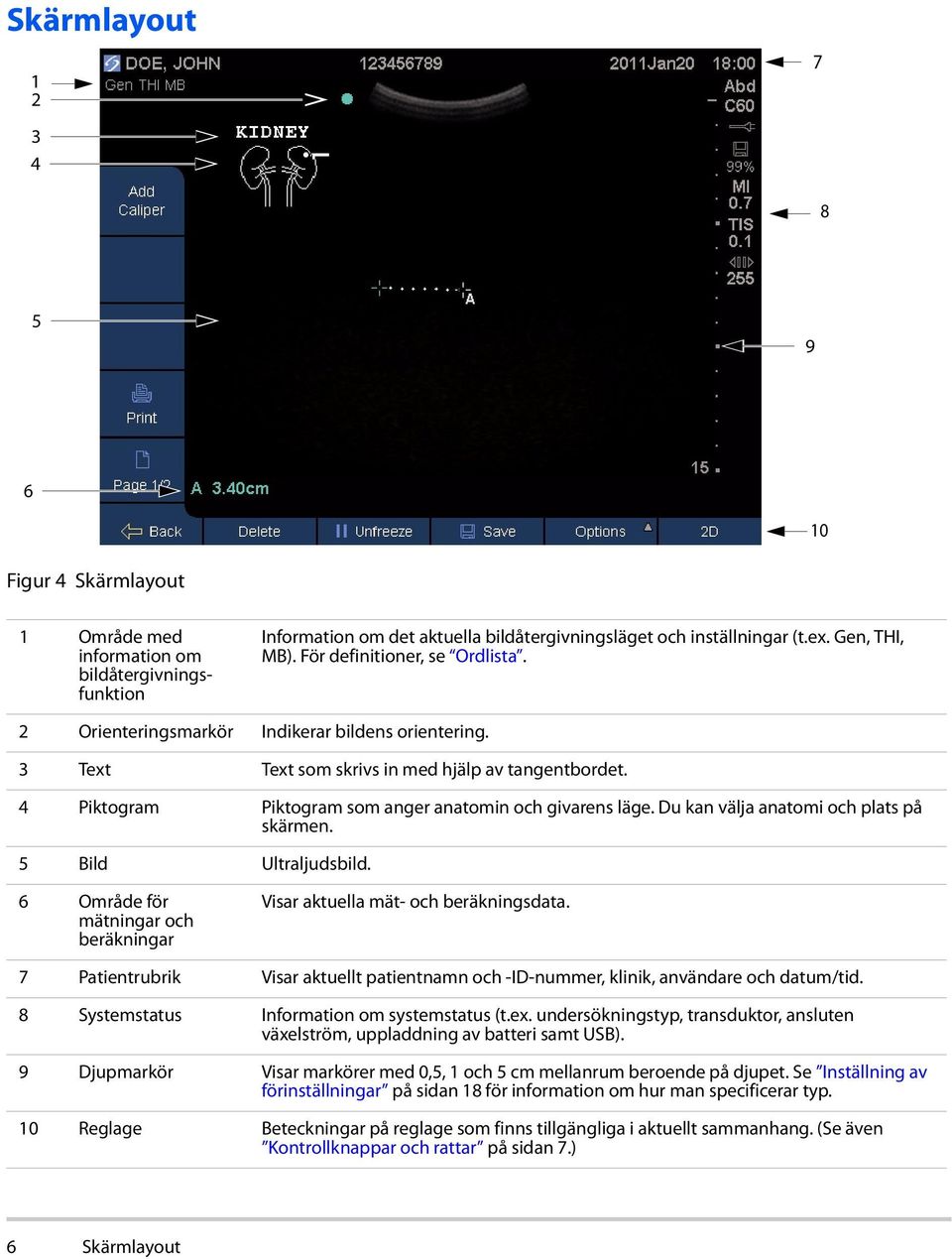 Du kan välja anatomi och plats på skärmen. 5 Bild Ultraljudsbild. 6 Område för mätningar och beräkningar Visar aktuella mät- och beräkningsdata.