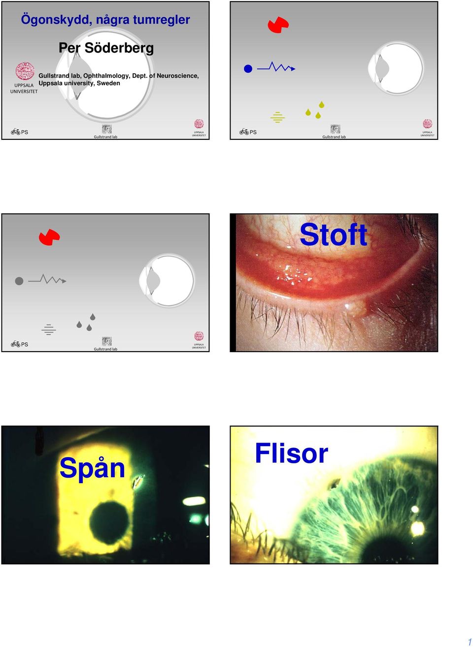 Pcn_3 ConjunctivitisVirusAde nofollicular Stoft UPALA UPALA