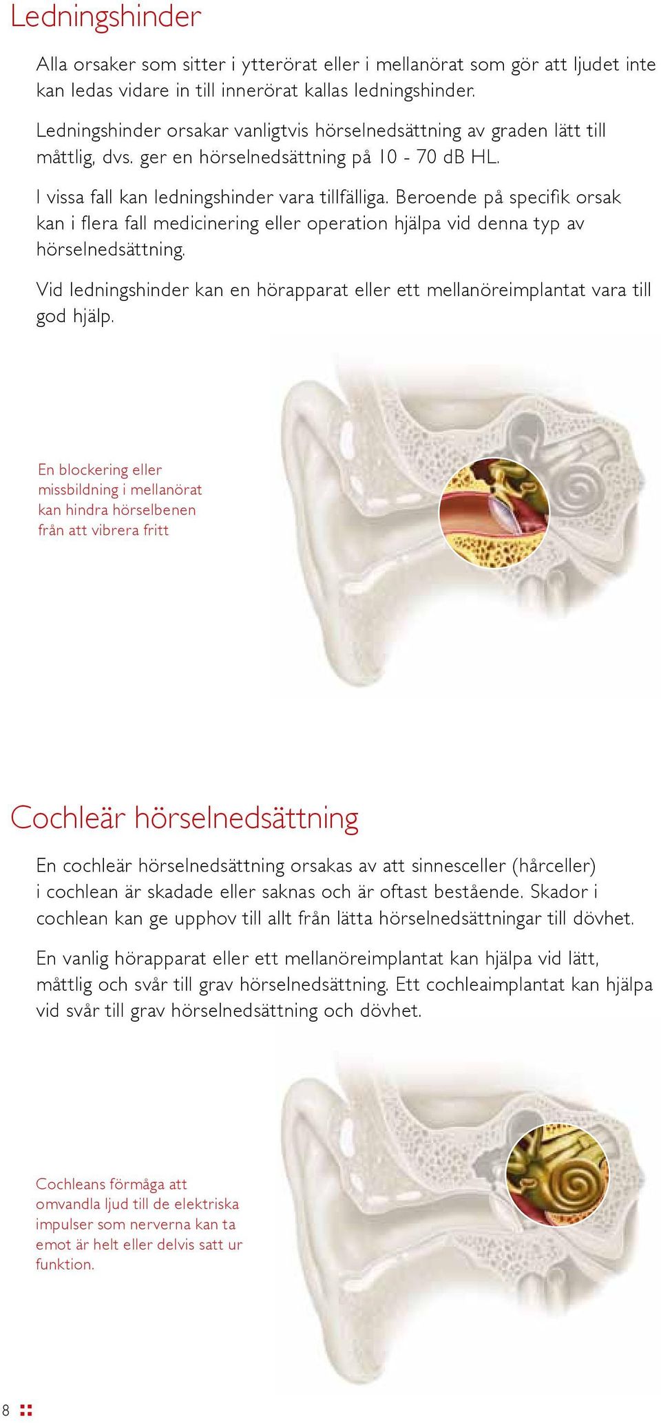 Beroende på specifik orsak kan i flera fall medicinering eller operation hjälpa vid denna typ av hörselnedsättning.