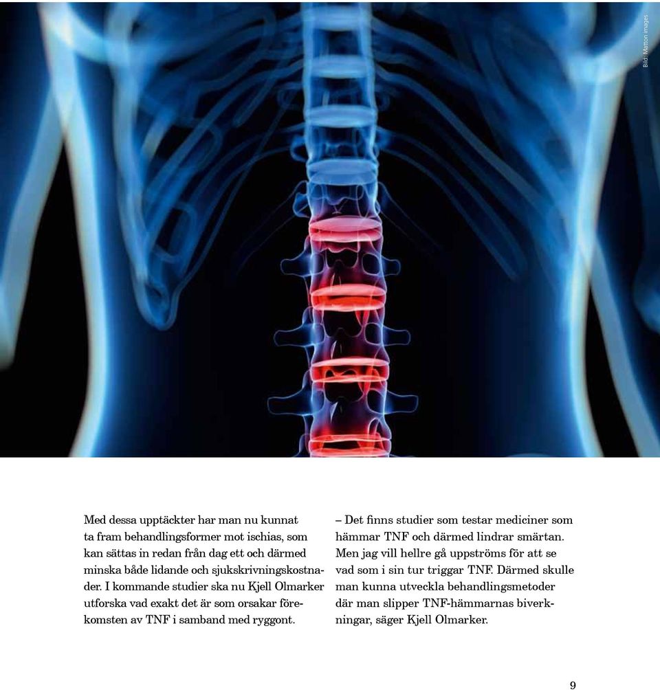 I kommande studier ska nu Kjell Olmarker utforska vad exakt det är som orsakar förekomsten av TNF i samband med ryggont.