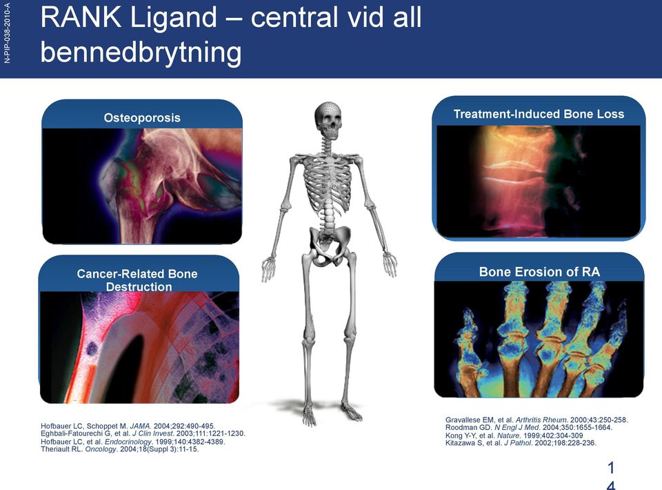 Endocrinology. 1999;140:4382-4389. Theriault RL. Oncology. 2004;18(Suppl 3):11-15. Gravallese EM, et al. Arthritis Rheum.